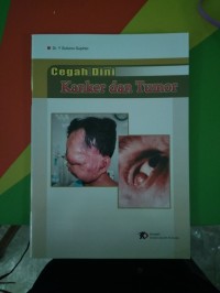 Image of Cegah Dini Kanker dan Tumor